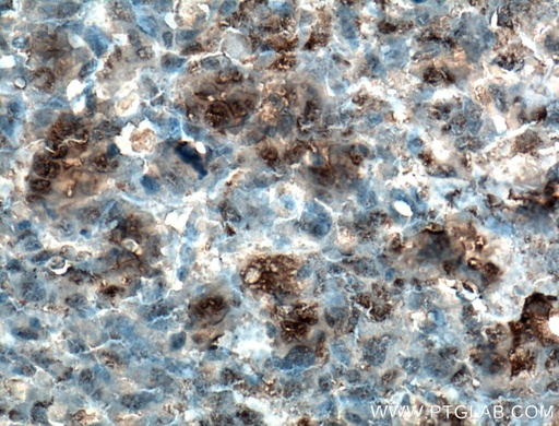[16157-1-AP-20UL] Osteocalcin Polyclonal antibody