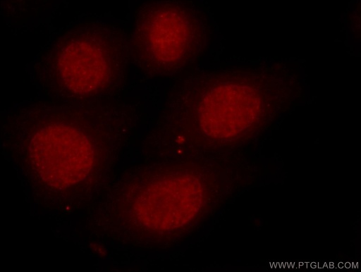 [16160-1-AP-150UL] HDAC1-specific Polyclonal antibody