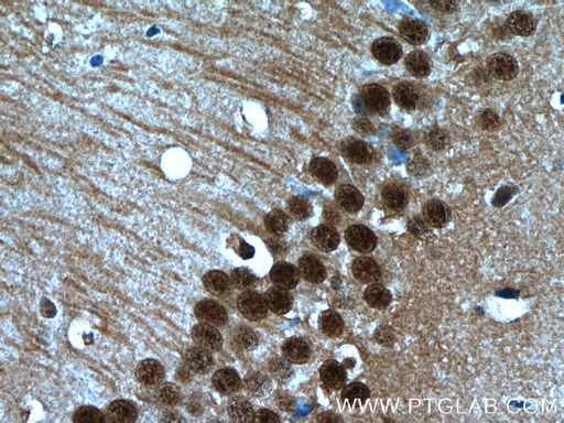 [16167-1-AP-20UL] HDAC6-specific Polyclonal antibody