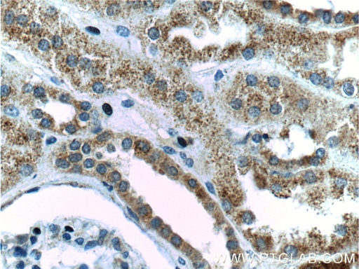 [16168-1-AP-20UL] PSEN2-Specific Polyclonal antibody