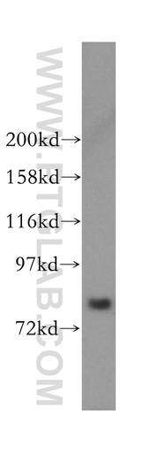 [16171-1-AP-150UL] MDM1-Specific Polyclonal antibody