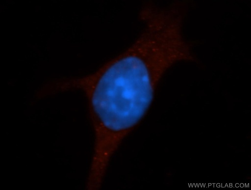 [16174-1-AP-150UL] Icam-1 Polyclonal antibody
