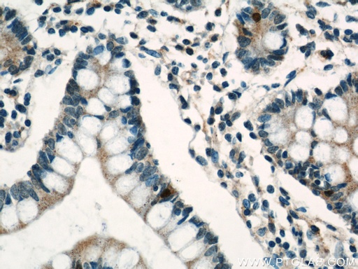 [16177-1-AP-150UL] Lin28A-specific Polyclonal antibody