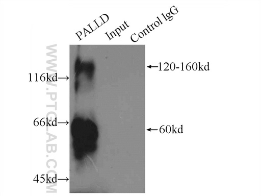 [16179-1-AP-150UL] Palladin-Specific Polyclonal antibody