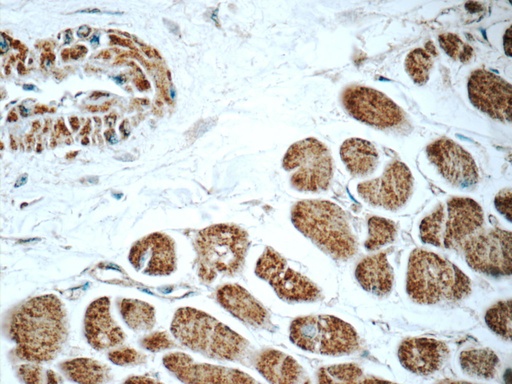 [16182-1-AP-20UL] RAB31-specific Polyclonal antibody