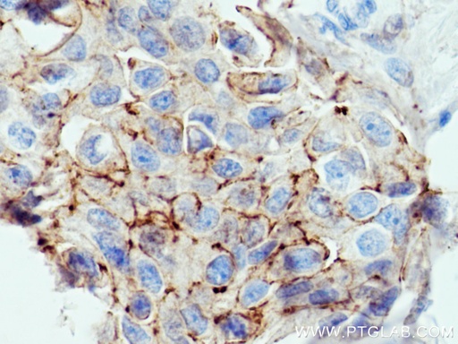 [16183-1-AP-150UL] F11R Polyclonal antibody