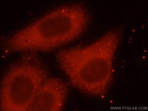 [16188-1-AP-20UL] ING4-specific Polyclonal antibody