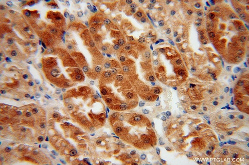 [16199-1-AP-150UL] HTF9C Polyclonal antibody