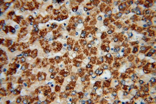 [16204-1-AP-150UL] ACSS3 Polyclonal antibody