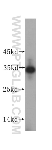 [16205-1-AP-150UL] IMP4 Polyclonal antibody