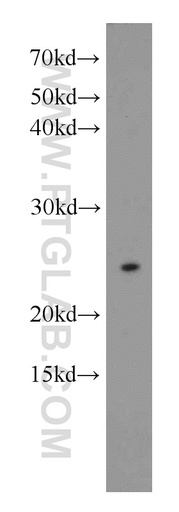 [16211-1-AP-20UL] N6AMT1 Polyclonal antibody