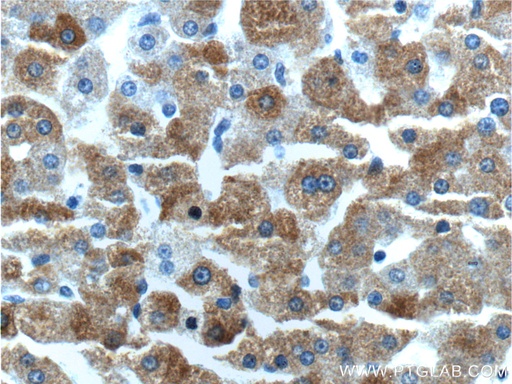 [16212-1-AP-150UL] MAP3K6 Polyclonal antibody
