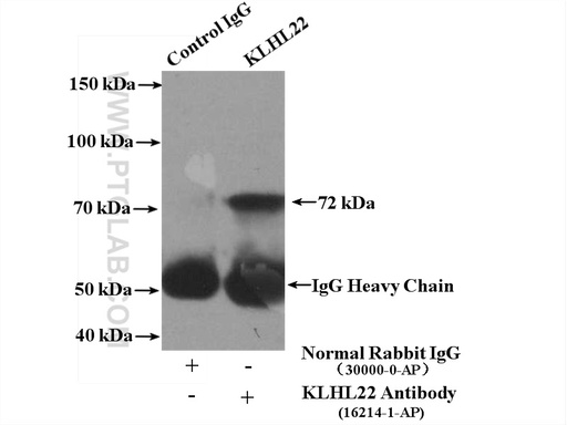 [16214-1-AP-150UL] KLHL22 Polyclonal antibody