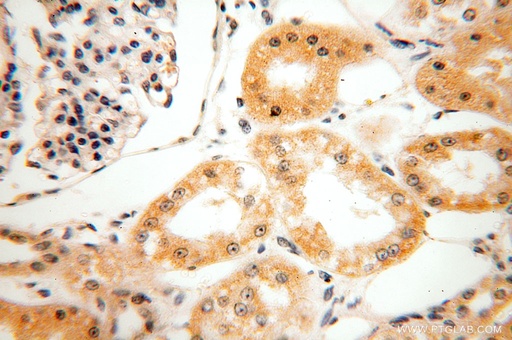 [16229-1-AP-150UL] HEXB Polyclonal antibody