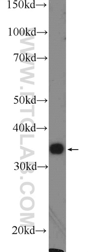 [16234-1-AP-20UL] FOXS1 Polyclonal antibody