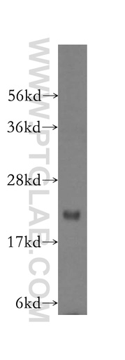 [16235-1-AP-20UL] MRPS18A Polyclonal antibody