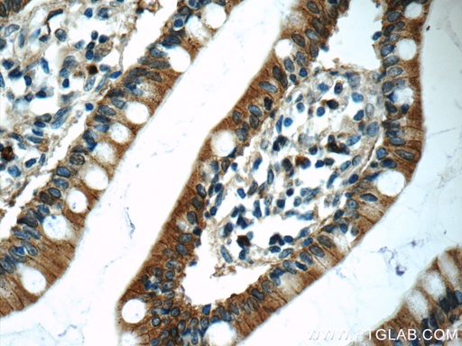 [16236-1-AP-20UL] Carboxypeptidase A3 Polyclonal antibody