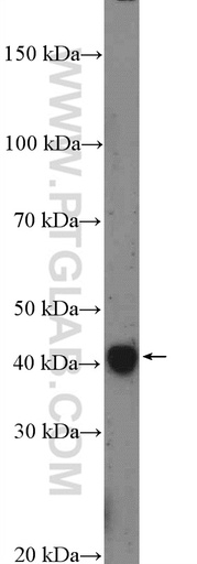 [16237-1-AP-20UL] SFRS5 Polyclonal antibody