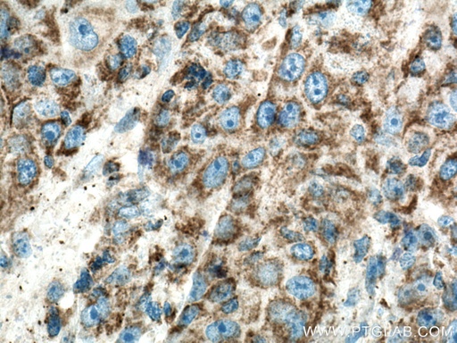 [16241-1-AP-150UL] MRPL13 Polyclonal antibody