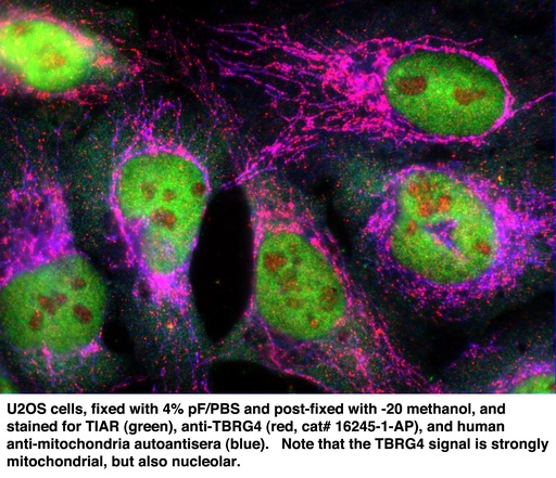 [16245-1-AP-150UL] TBRG4 Polyclonal antibody