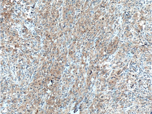 [16246-1-AP-20UL] SAT2 Polyclonal antibody