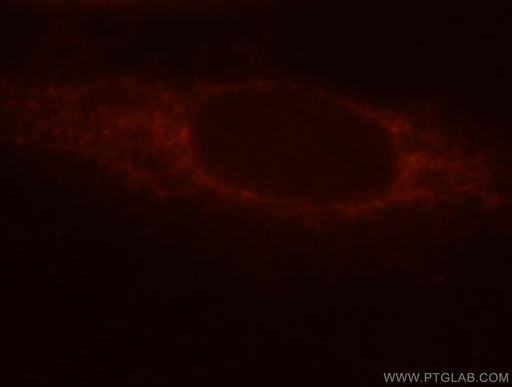 [16249-1-AP-150UL] LMF2 Polyclonal antibody