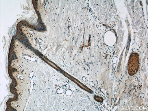 [16252-1-AP-20UL] DMKN Polyclonal antibody