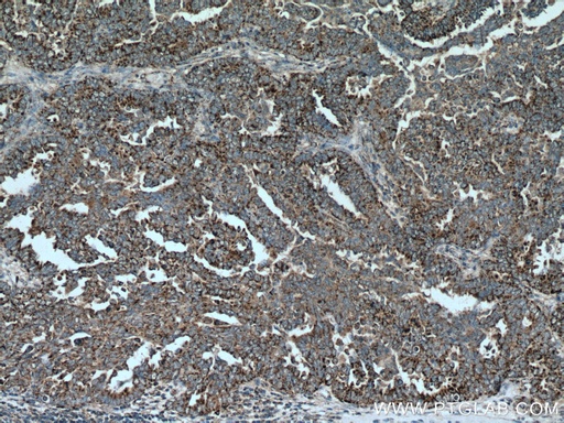 [16260-1-AP-150UL] GADD45GIP1 Polyclonal antibody