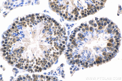 [16262-1-AP-150UL] MED28 Polyclonal antibody