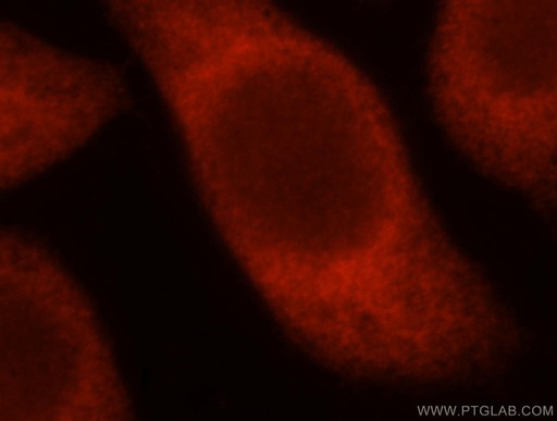 [16263-1-AP-20UL] TSR2 Polyclonal antibody