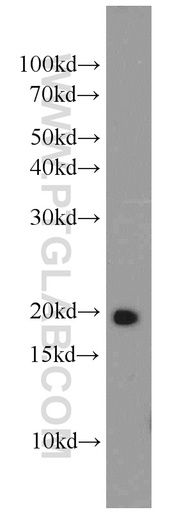 [16266-1-AP-20UL] RAP2B Polyclonal antibody