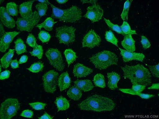 [16271-1-AP-150UL] GCC1 Polyclonal antibody