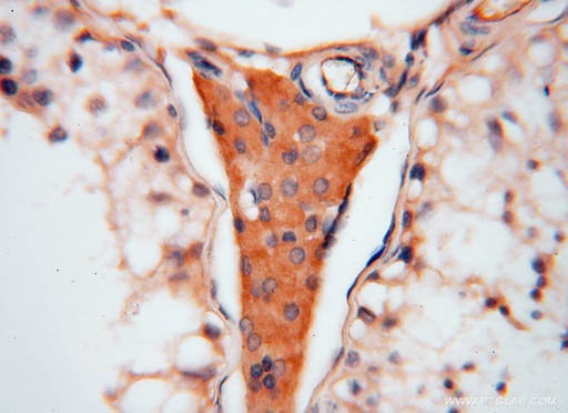 [16274-1-AP-150UL] ATP6V1C2 Polyclonal antibody
