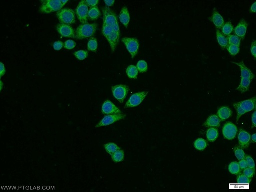 [16277-1-AP-150UL] RPL11 Polyclonal antibody
