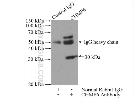[16278-1-AP-20UL] CHMP6 Polyclonal antibody