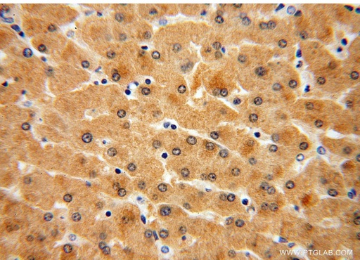 [16282-1-AP-20UL] GNPNAT1 Polyclonal antibody