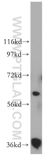 [16283-1-AP-150UL] RDH14 Polyclonal antibody