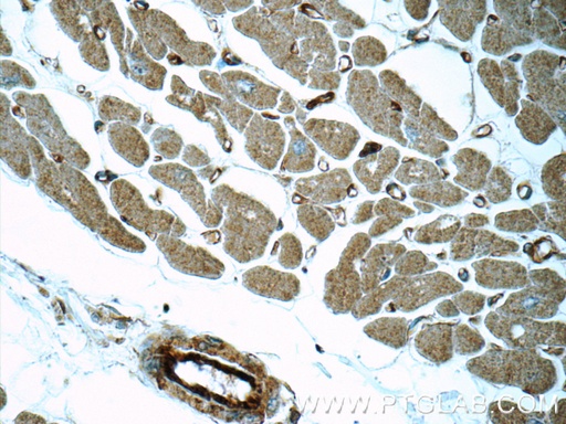 [16287-1-AP-150UL] MYL12A Polyclonal antibody