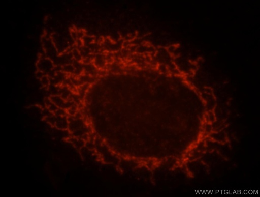 [16288-1-AP-20UL] MRPS31 Polyclonal antibody