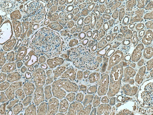 [16293-1-AP-20UL] CDC37L1 Polyclonal antibody