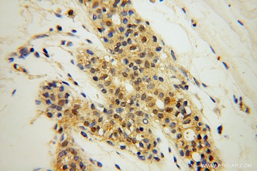 [16294-1-AP-150UL] SPAG7 Polyclonal antibody