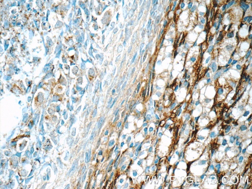 [16303-1-AP-150UL] HSD17B11 Polyclonal antibody