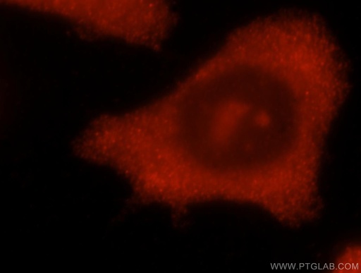 [16304-1-AP-20UL] CHAC2 Polyclonal antibody