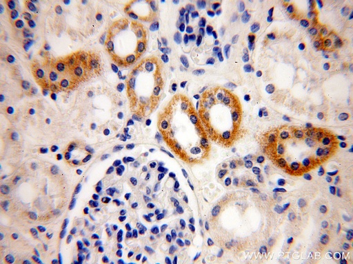 [16307-1-AP-20UL] ATP5L Polyclonal antibody