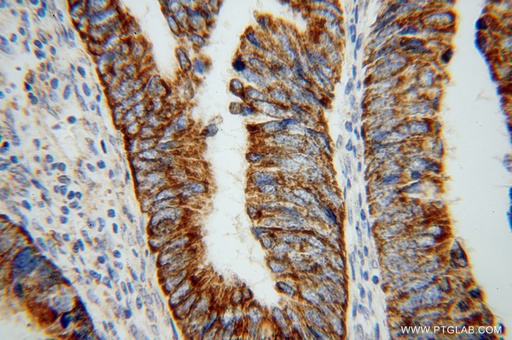 [16311-1-AP-20UL] TST Polyclonal antibody