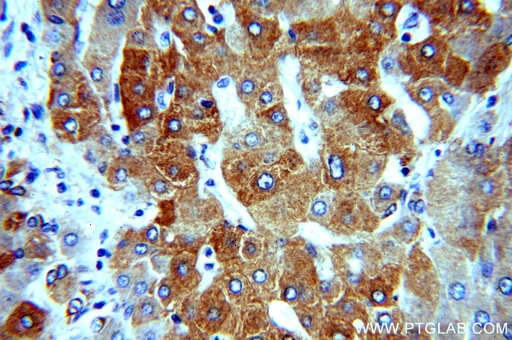 [16314-1-AP-150UL] dGK Polyclonal antibody