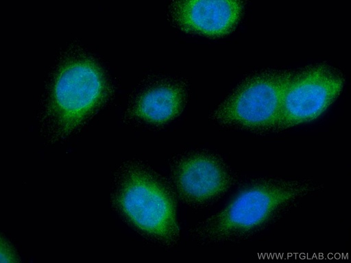 [16318-1-AP-20UL] UAP1 Polyclonal antibody