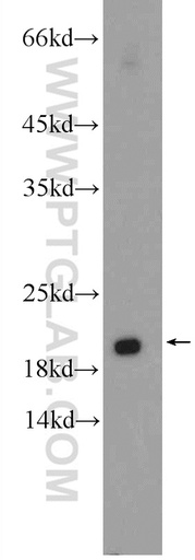 [16328-1-AP-20UL] RAB30 Polyclonal antibody