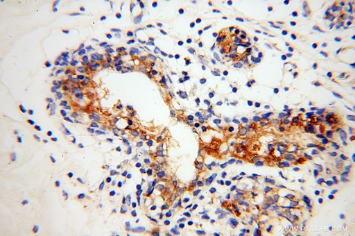 [16332-1-AP-150UL] GUSB Polyclonal antibody