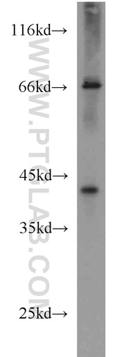 [16340-1-AP-150UL] GFOD2 Polyclonal antibody